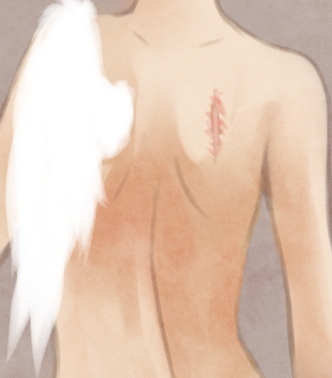Pic.Source: "ZoA- Backpains LELEE" by Arcuu @deviantart.com